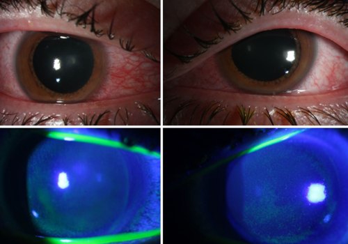 Do UV Lights Stay On All the Time?